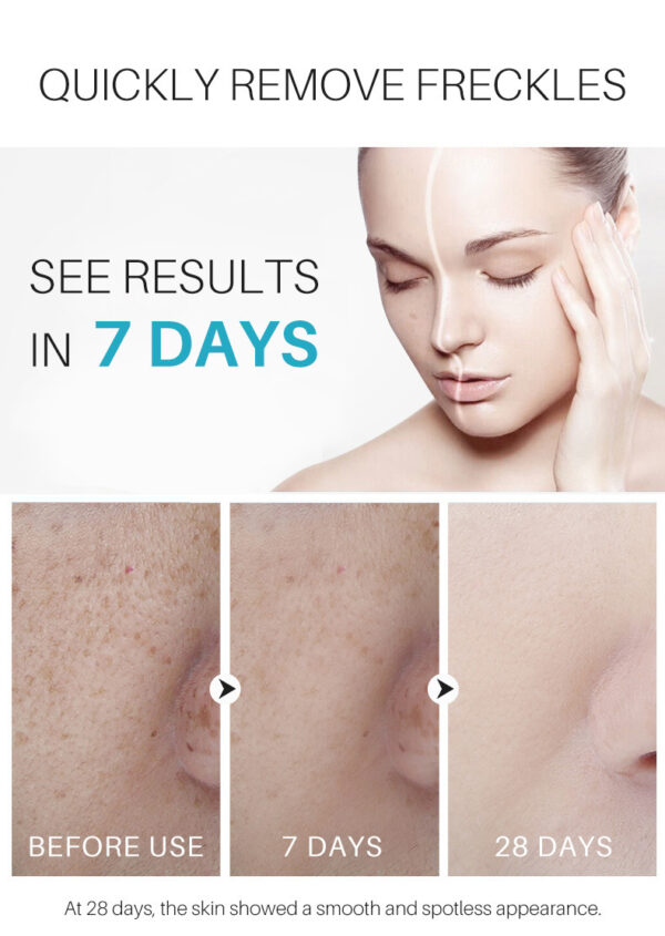 Spot Black Cream Rose Scent Repair Skin - Image 6